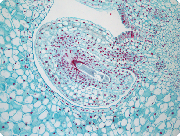 Ilium Brownii (INFINITY3-3UR). 10x Objective, 10 ms Exposure, 1.2x Gain, 1.0 Gamma.