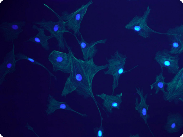 Fluorescence (INFINITY3-1UR)