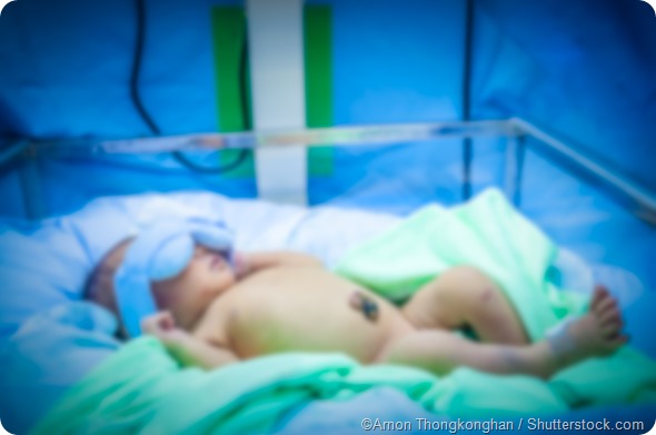 Newborn baby hospital - Arnon Thongkonghan