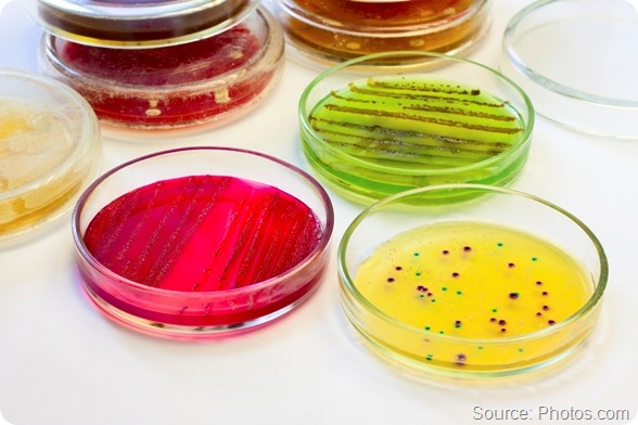 Petri dishes with bacterial colonies