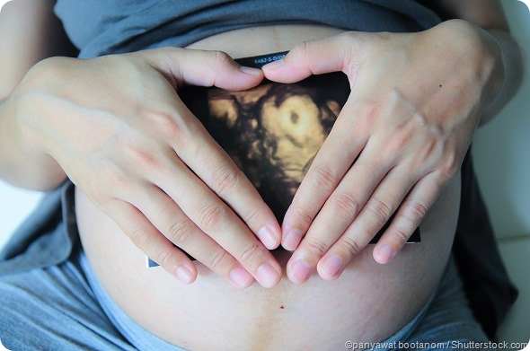 Pregnancy ultrasound