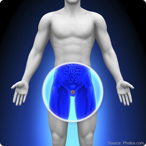 Medical X-Ray Scan - Prostate