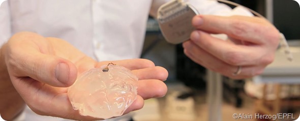 wireless brain implant