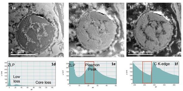 an unfiltered TEM bright field image