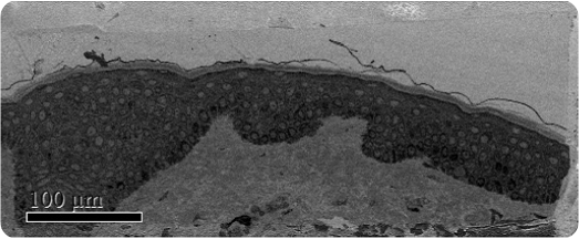 Low magnification SBFSEM image