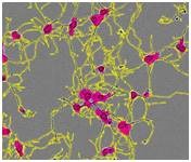 Segmentation masking of rat E18 cortical neurons
