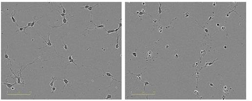 Qualitative observation of neurotoxic effect