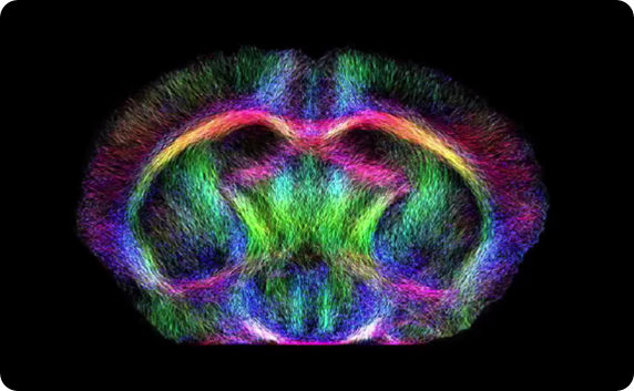 Resting state fMRI with diffusion tensor imaging combined with fiber tracking, with neurological applications