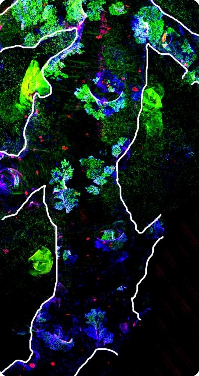 This photo shows the same airway after a severe chemical injury that wipes out the normally present cells and activates stem cell mediated repair (clonal patches). Credit: Cancer Research UK