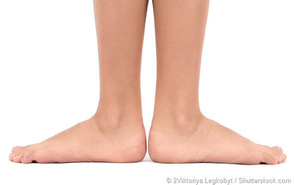 Flat foot