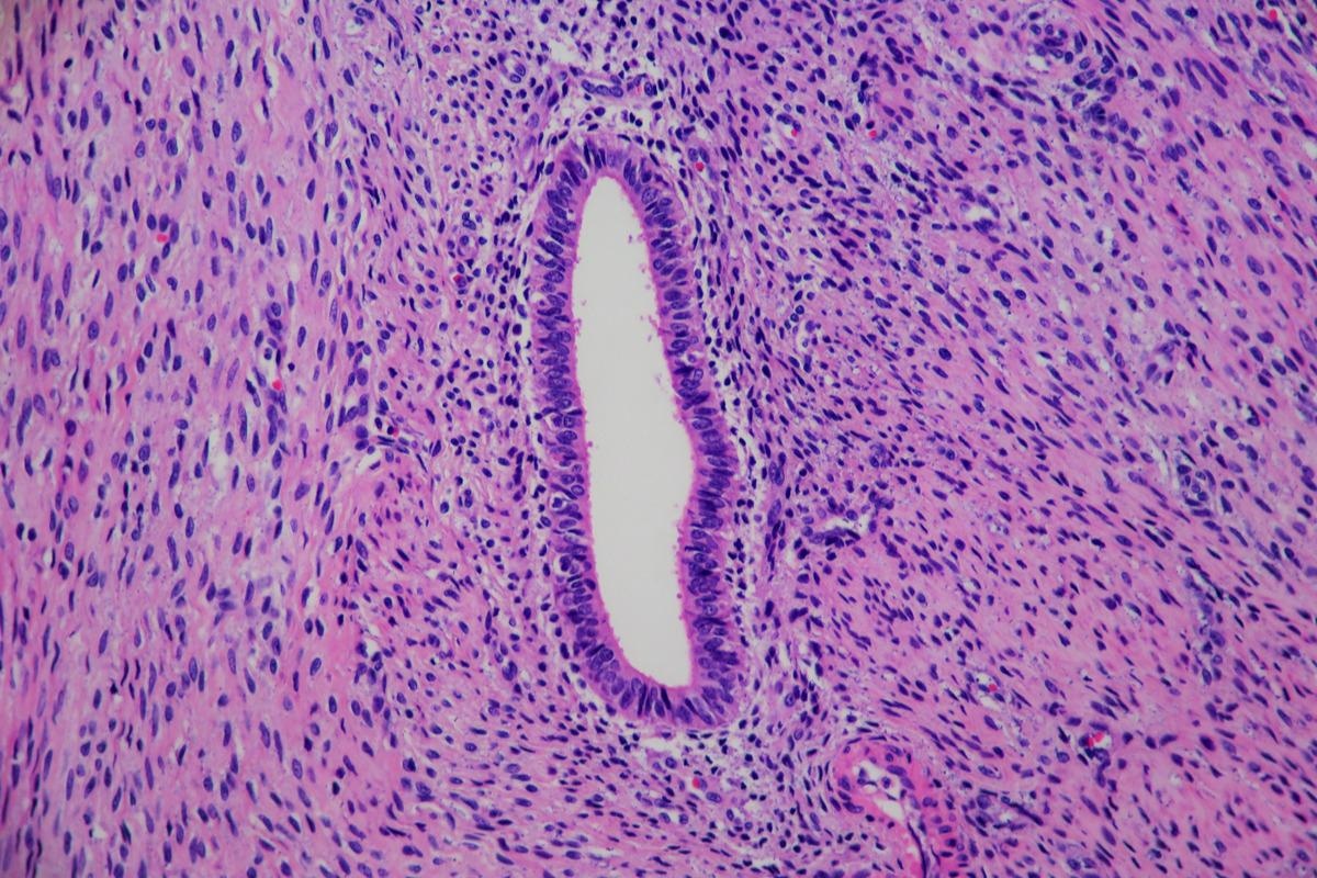 Image Credit: Lisa Culton/Shutterstock