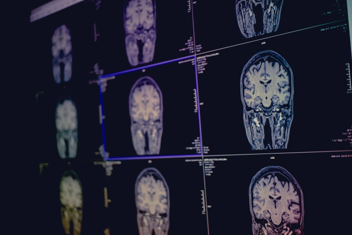 Image Credit: Atthapon Raksthaput/Shutterstock