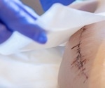 The Science Behind Silicone Scar Tape