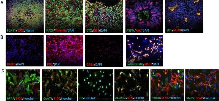 ICC shows expression of key markers for axoCells cortical excitatory neurons (CENs), cortical inhibitory interneurons (CINs) and astrocytes (A) axoCells iPSC-derived neural stem cells (NSCs, ax0015) show expression of all standard NSC markers: FOXG1, SOX2, PAX6, Vimentin, OTX, Ki67, ZO1 and NCAD. (B) In contrast, axoCells CINs (DIV20, ax0667) express the key markers GAD65, Parvalbumin (PVB), Beta, Somatastatin and MAP2. (C) axoCells iPSCderived astrocytes (ax0665) express key astrocyte-specific markers (GFAP and S100B) and astrocyte-associated markers, EAAT1, Glutamine Synthetase (GS) and ALDH1L1, while showing very low levels of neuronal progenitor markers Nestin and MAP2