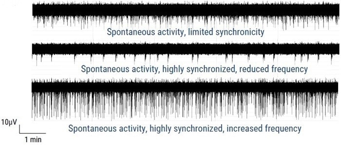 Axion MEA traces of axoCells CENs in monoculture, in isogenic co-culture with axoCells CINs and in isogenic tri-culture with axoCells CINs & astrocytes. The Axion MEA traces above show typical activities on DIV35. In monoculture (Top) the CENs fire frequently and spontaneously but with limited synchronicity. The addition of CINs (Middle) markedly reduces firing rate but switches activity to a more regular synchronized burst firing pattern. The addition of astrocytes (Bottom) increases both firing rate and spike amplitude while maintaining the regular synchronized burst firing seen in the co-culture model. This shows the expected functional modulation with increasing model complexity, demonstrating functional validation of the model.
