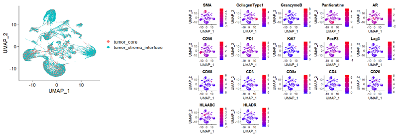 Unsupervised Analysis of mCRPC Tumor Microenvironment Reveals Distinct Immune Subpopulations and Drug Resistance Profiles