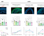 Evaluating consistency in large-scale human iPSC retinal organoids