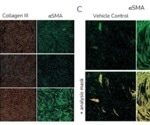 High-content imaging assay for fibroblast activation and matrix deposition in pulmonary fibrosis