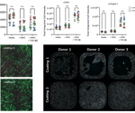 Advancing in vitro assays to model fibroblast-to-myofibroblast transition in fibrosis