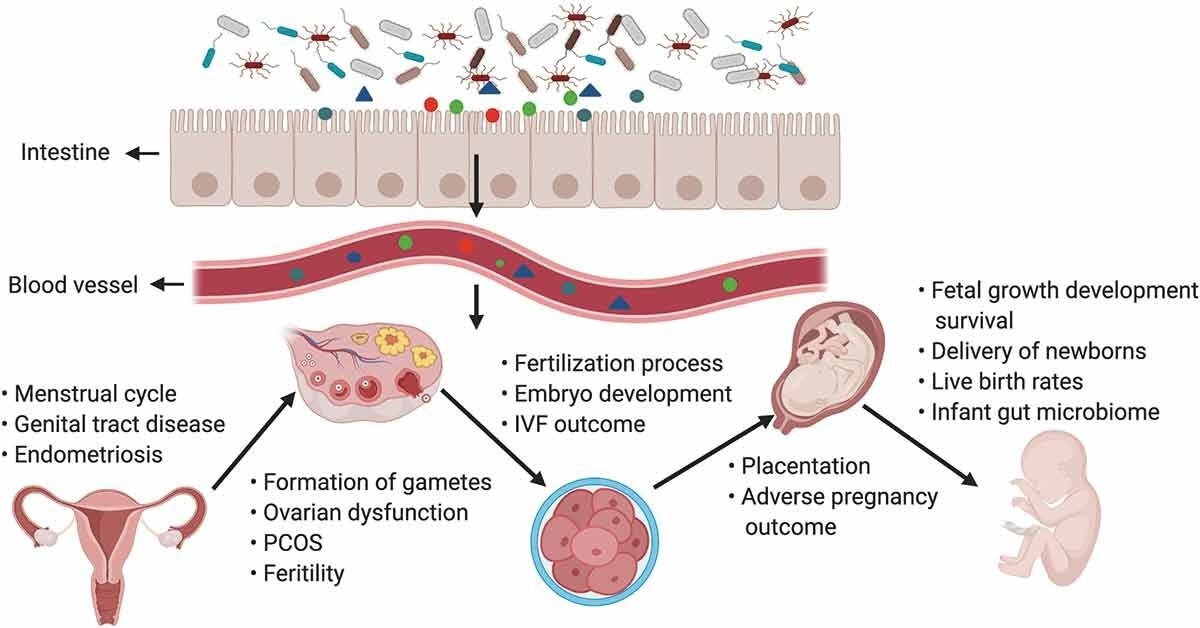 The gut microbiota and its impact on the female reproductive tract, embryo development, and pregnancy. Products of gut microbiota may be transported through the circulation and influence the female reproductive tract (e.g., may cause disruptions in the menstrual cycle, genital tract disease, and endometriosis), ovarian function, embryonic development, and the health of the mother and fetus. The gut can affect the formation of gametes, embryo development, and fertilization processes, and alteration of intestinal flora can lead to ovarian dysfunction, PCOS, infertility, and adverse IVF outcomes. In pregnant women, the gut microbiota has an effect on placentation, pregnancy outcomes, the delivery of newborn babies, the infant microbiome, the live birth rate, and fetal growth, development, and survival.