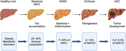 A Gene based strategy to prevent the progression of Non-Alcoholic Fatty Liver Disease (NAFLD)