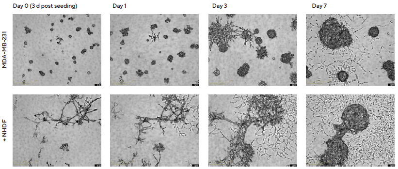 Temporal effects on morphology revealed through Incucyte® DF Brightfield imaging.