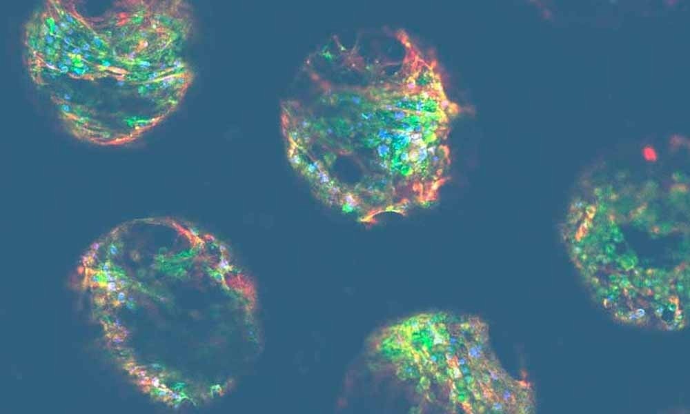 What are the sub-types of drug-induced liver injury (DILI)?