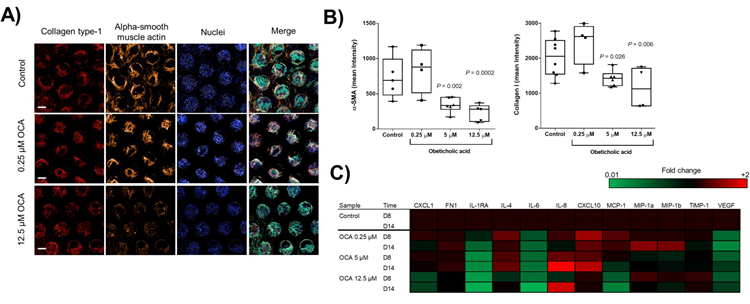OCA treatment of liver MPS microtissues reduces NASH phenotype. Liver microtissues were cultured in the Liver MPS for 15 days and after 4 days cultures were dosed daily with the FXR agonist OCA or vehicle 0 1% DMSO). A) Confocal microscopy images of microtissues from each condition at the end of study (representative images shown). For each scaffold 8 regions of interest acquired and each biological condition has
