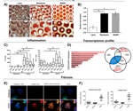 Modeling the interaction between the intestine and liver in a multi-organ microphysiological system for studying metabolic-dysfunction associated steatotic liver disease
