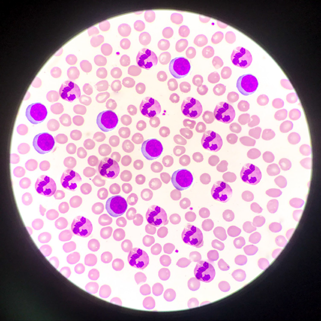 What are the sources of red blood cell contamination?