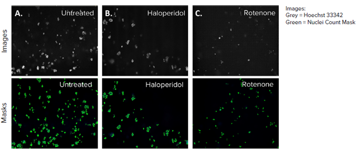 HepG2 3D cell model DAPI images, 10X single site image (top panel), and their representative nuclei count analysis masks generated by MetaXpress software (bottom panel) A) Untreated control, B) Haloperidol (4 μM), C) Rotenone (4 μM). The DAPI mask counted the number of nuclei present in each site and the control (A) had the most nuclei owing to no toxicity.