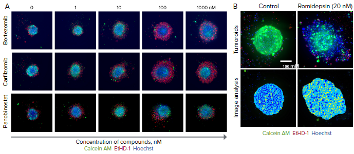Tumoroids were treated with compounds for 5 days then stained with calcein AM (green), EthD-1 (red), and Hoechst (blue). A) Selected confocal images, 10X shown. Note dose-dependent dis-integration of tumoroids, increase in cell death indicated as increase of EthD-1 staining (in red). B) End-point analysis of fluorescent images was done using Custom Module Editor in MetaXpress. Images of the nuclei of treated and untreated tumoroid shown. Analysis masks show tumoroids projection in blue and nuclei in yellow. Tumoroid area and count nuclei were used as main read-outs for phenotypic characterization of tumoroids and compound effects.
