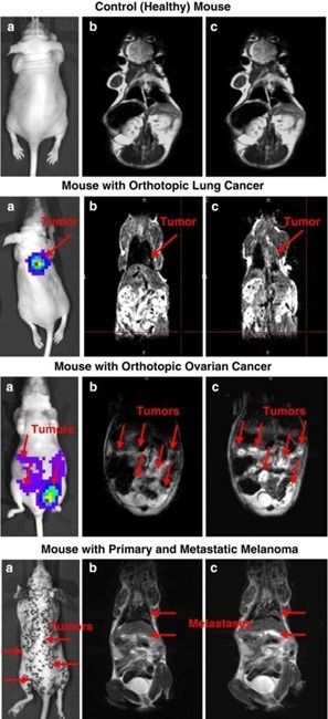 Tumor-targeted responsive nanoparticles for MRI and therapy