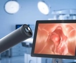 Chief ray angle (CRA): The hidden factor behind endoscopic technology