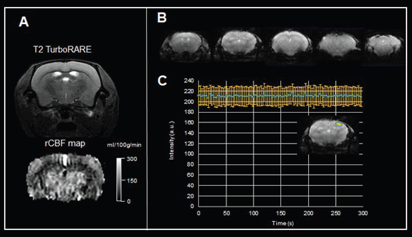 Functional MRI of the brain. A) Pulsed arterial spin labeling of the mouse brain. Shown are a T2-weighted TurboRARE image for anatomical reference,  and the rCBF map computed from the flow-sensitive alternating inversion recovery (FAIR)-EPI method. Data were acquired with a BioSpec Maxwell 94/17 using a linearly polarized bird-cage resonator for transmission and a phased-array receive-only surface coil in cross-coil mode under isoflurane anesthesia. B) Example of gradient echo EPI images of the mouse brain acquired with a BioSpec Maxwell 94/17 equipped with a 23 mm volume coil. Shown are five 0.6 mm thick axial slices with an in-plane resolution of 141 μm x 156 μm. C) The time course characteristics of EPI imaging for fMRI studies were assessed by acquiring 100 repetitions of gradient echo EPI over an acquisition time of 5 minutes with active drift compensation. Acquisition shows solid time course stability with a temporal signal-to-noise ratio = 123