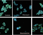 AI-driven toxicity assessment in 3D intestinal organoids