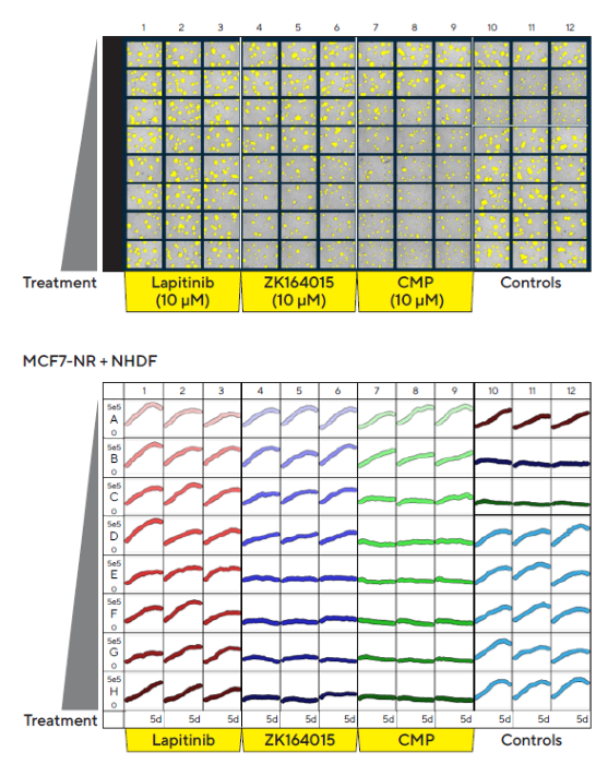 Incucyte® S3 vessel views enable rapid visualization and quantification of treatment effects. MCF7 cells co-cultured with NHDFs were seeded in pre-coated (Matrigel) flat bottom 96-well plates (1:1 ratio, 1,000 cells/well of each) and multi-spheroids allowed to form (3 d). Spheroids were then treated with serial dilutions of known standard of care and cytotoxic compounds (5 d). Incucyte® microplate vessel views show effects of treatments on multi-spheroid size. Top image shows Brightfield Object Area (μm2) segmentation mask (yellow) 5 d post treatment. Bottom image shows the individual well Total Brightfield Object Area (μm2) (y-axis) over time (0–5 d post treatment) (x-axis)
