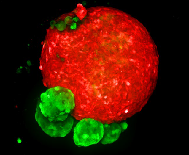 MaxIP image of 3D tumor co-culture microtissue - NCI-N87-GFP (gastric carcinoma; green) and NIH-RFP (murine fibroblast; red)