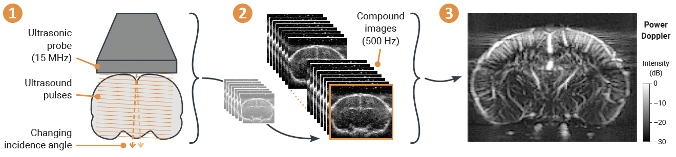 The principle of functional ultrasound.