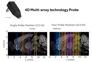 Mapping brain networks using functional ultrasound