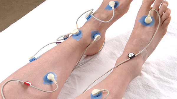 Transcutaneous monitor for assessing tissue oxygen