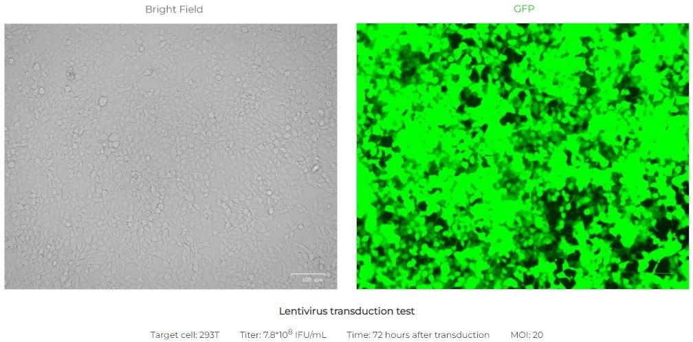 Lentiviral vectors for integration of the gene