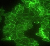 Induced pluripotent stem cell (iPSC) cytokines