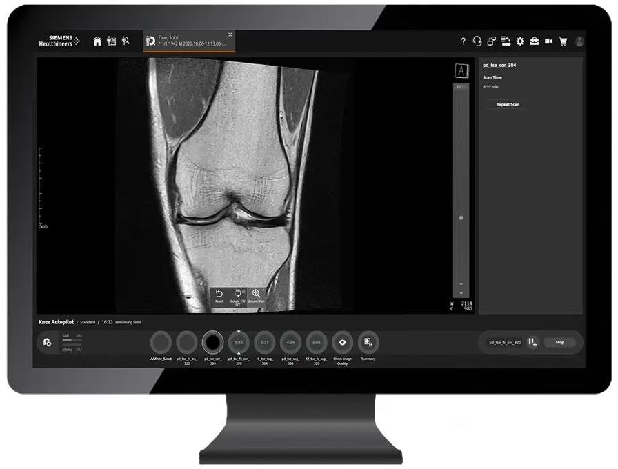 1.5T MRI system MAGNETOM Sola