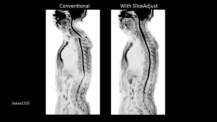 3T MRI scanner MAGNETOM Vida