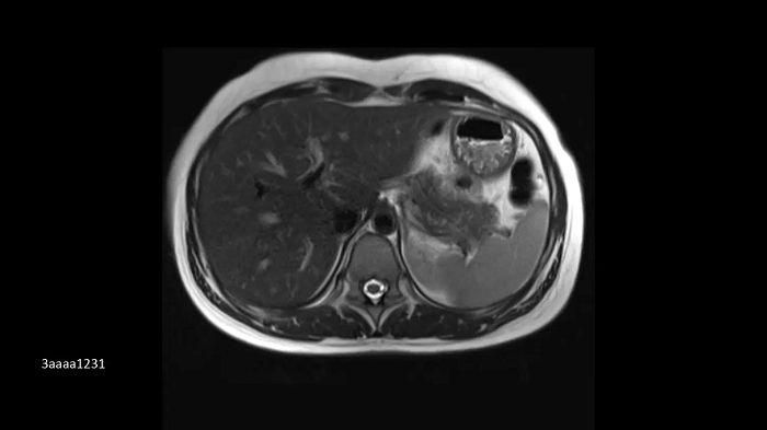 3T MRI scanner MAGNETOM Vida