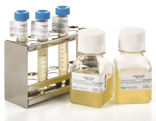 Human plasma for diagnostic testing