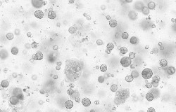 Human liver cancer organoids were cultured with FGF2 (Cat#: 10014-HNAE), HGF (Cat#: 10463-HNAS), FGF7 (Cat#: 10210-H07E), EGF (Cat#: 50482-MNCH), FGF10 (Cat#: 10573-HNAE), TGFB1 (Cat#: 10804-HNAC), NOG (Cat#: 50688-M02H), and RSPO1 (Cat#: 11083-HNAS).