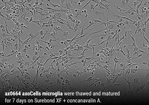 axoCells Microglia showing expected morphology, with different phenotypes demonstrating sub-populations with specified functions.