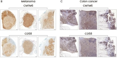 Sequential sections from tumor biopsies of three melanoma patients (B) and three colon cancer patients (C) were stained for CMTM6 and CD58 (Cat#: 12409-R126, Sino Biological), showing co-localization of CD58 with CMTM6.